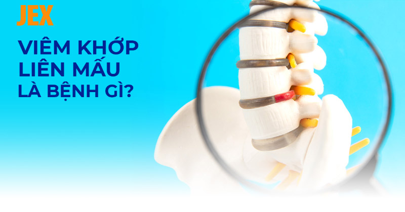 Viêm khớp liên mấu cột sống: Nguyên nhân, dấu hiệu, cách cải thiện