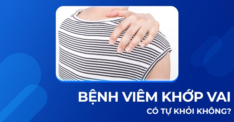 Bệnh viêm khớp vai có tự khỏi không? Làm gì để cải thiện hiệu quả?