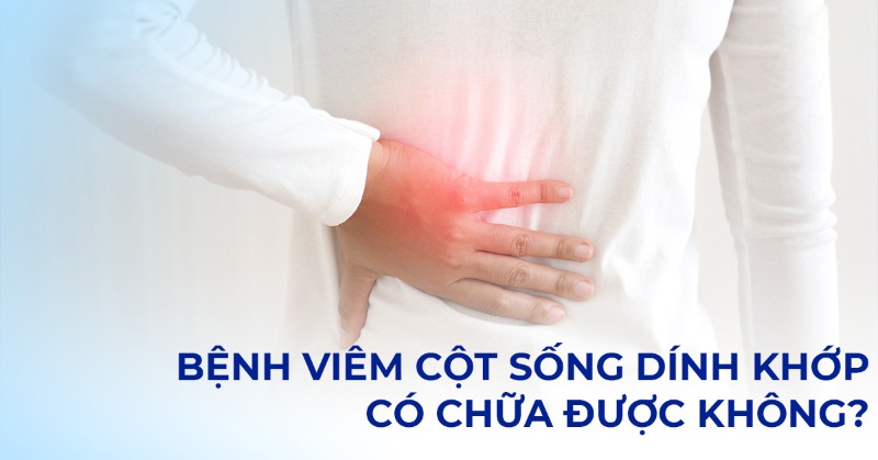 Bệnh viêm cột sống dính khớp có chữa được không? [Chuyên gia tư vấn]