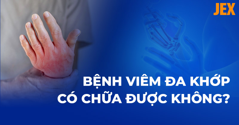 Bệnh viêm đa khớp có chữa được không? Làm gì để cải thiện hiệu quả?