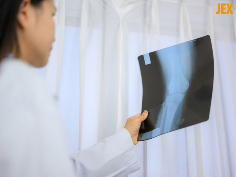 Chụp Xquang giúp chẩn đoán giả Gout