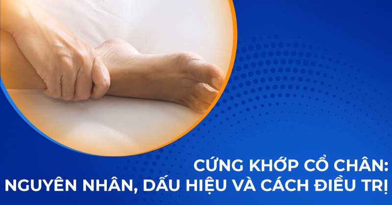 Cứng khớp cổ chân: Nguyên nhân, dấu hiệu và cách điều trị