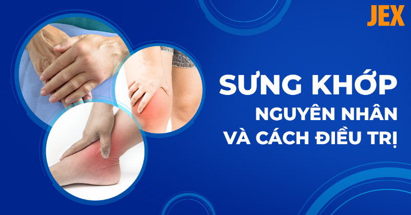 Sưng khớp là gì? Nguyên nhân, dấu hiệu, phòng ngừa và điều trị