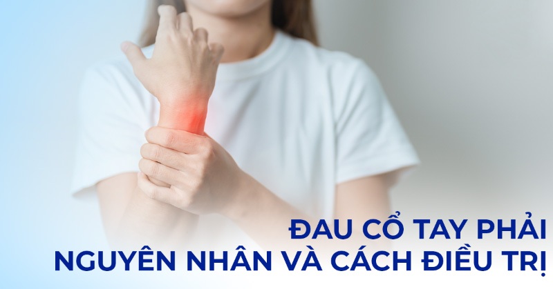 Đau cổ tay phải: Nguyên nhân, triệu chứng và cách chữa trị