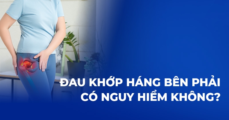 Đau khớp háng bên phải: Nguyên nhân, dấu hiệu và cách điều trị