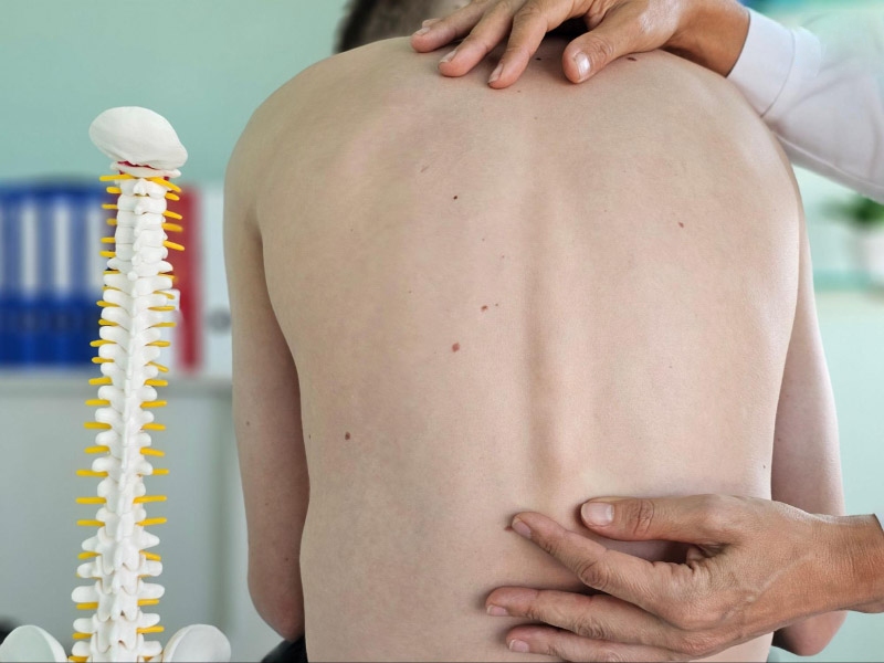 Viêm cột sống dính khớp gây gù lưng