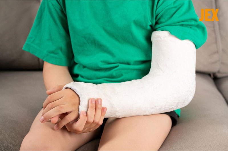 Chấn thương khớp có thẻ gây biến chứng viêm khớp