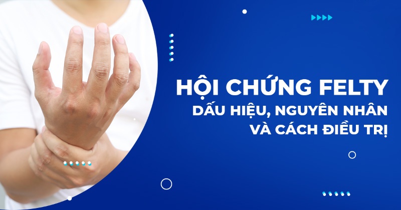 Hội chứng Felty: Nguyên nhân, triệu chứng, điều trị, phòng ngừa