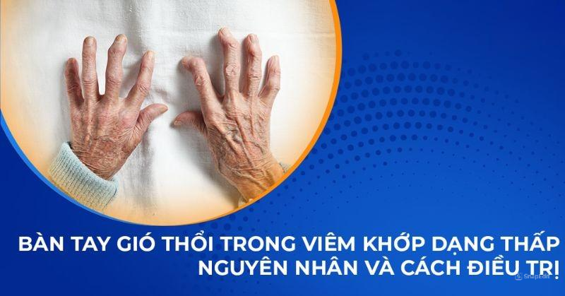 Bàn tay gió thổi trong viêm khớp dạng thấp: Nguyên nhân, điều trị