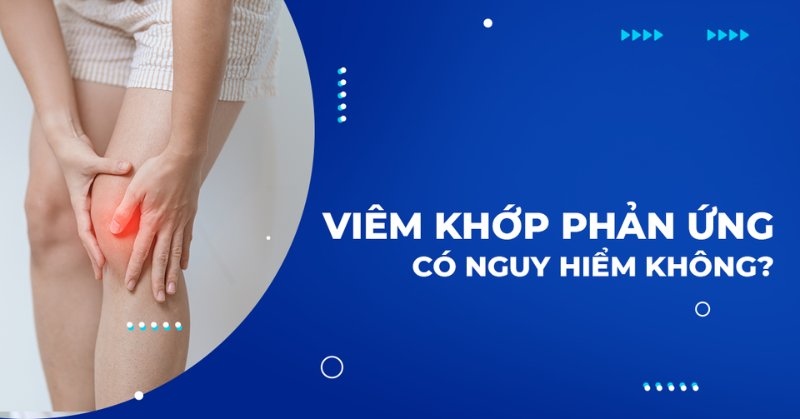 Viêm khớp phản ứng có nguy hiểm không? Những biến chứng thường gặp