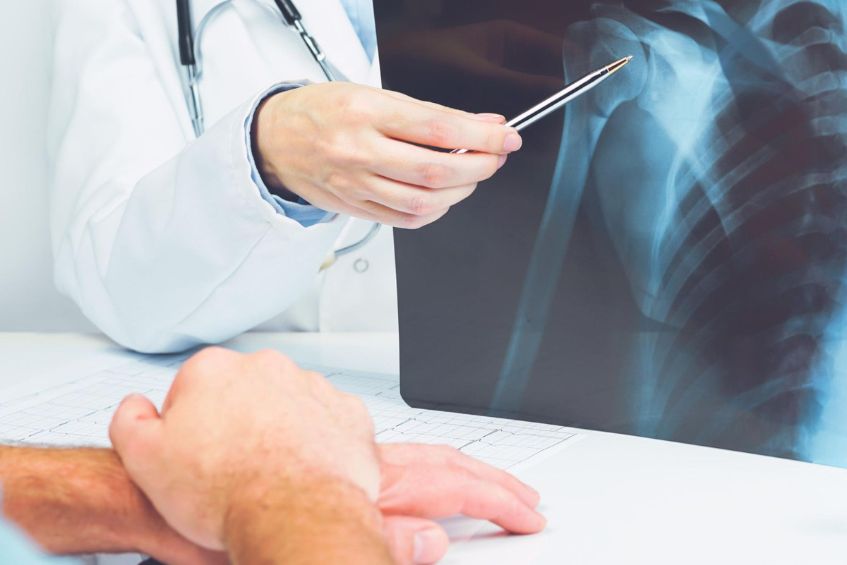 Chẩn đoán đau vai gáy lan xuống cánh tay