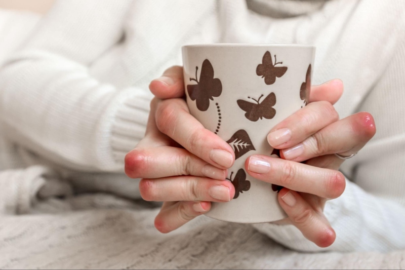 Hạt thấp khớp kèm nóng đỏ trên da