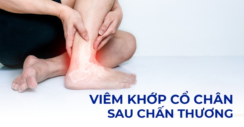 Viêm khớp cổ chân sau chấn thương xử lý thế nào? Nguyên do vì sao?