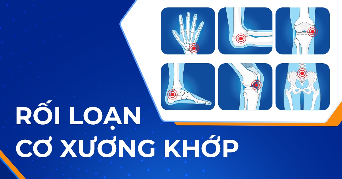 Rối loạn cơ xương khớp và những lý do cụ thể