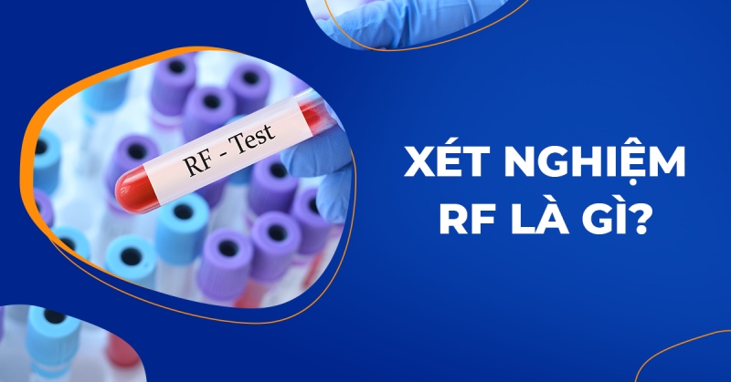 Xét nghiệm RF là gì? Ý nghĩa, cách đọc chỉ số và chi phí thực hiện