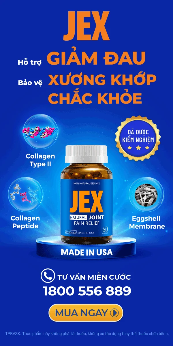 Banner JEX widget MB