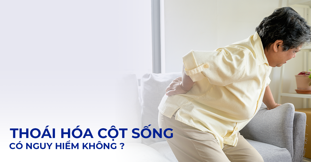 Thoái hóa cột sống có nguy hiểm không? Biến chứng cần lưu ý