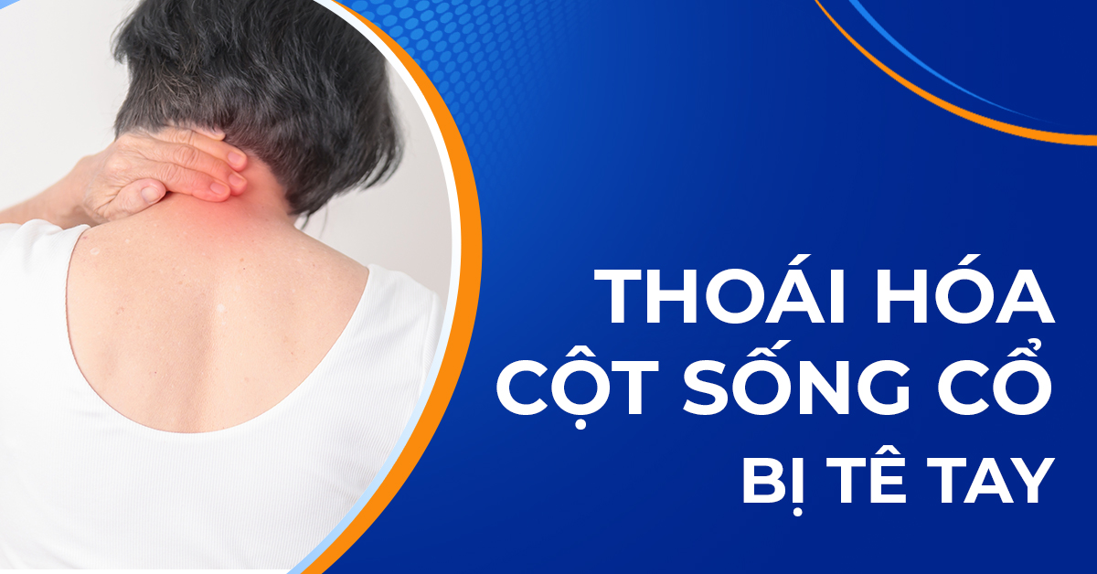 Thoái hóa đốt sống cổ bị tê tay do đâu và cách khắc phục
