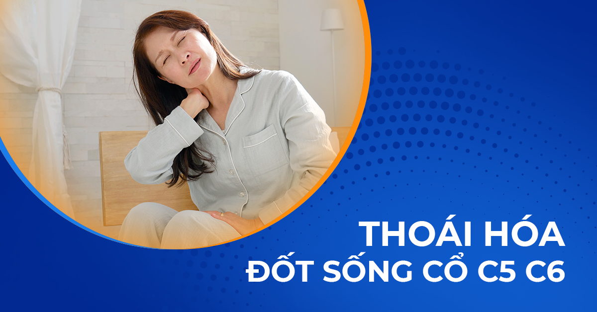 Tổng quan về thoái hóa đốt sống cổ C5 C6