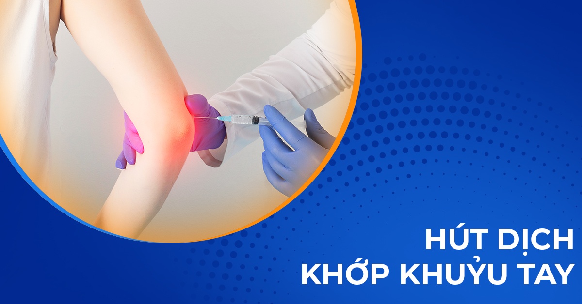 Chọc hút dịch khớp khuỷu tay: Quy trình, khi nào cần thực hiện