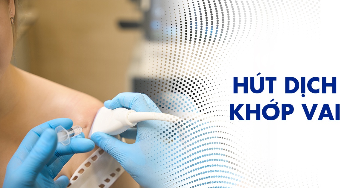 Chọc hút dịch khớp vai: Quy trình, kỹ thuật, lợi ích và rủi ro