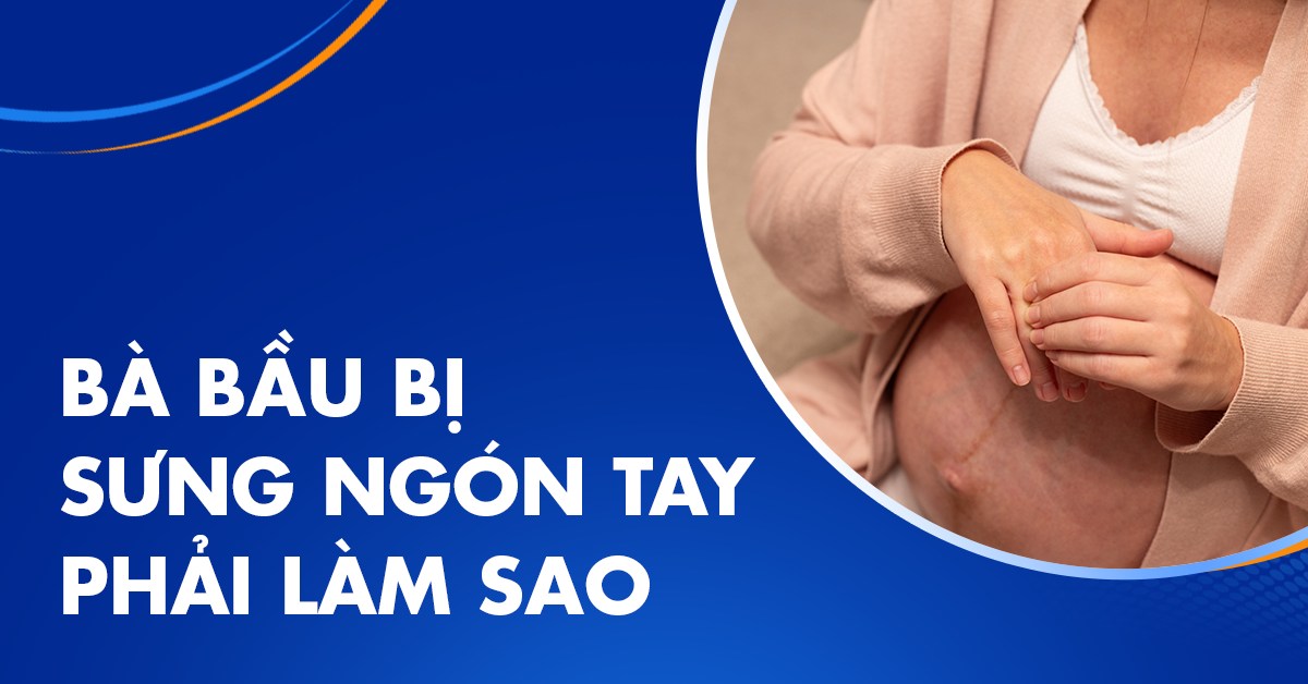 Bà bầu bị sưng ngón tay: có đáng lo  không?