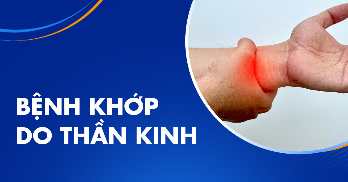 Cơ chế hình thành bệnh khớp do thần kinh và biểu hiện thường gặp
