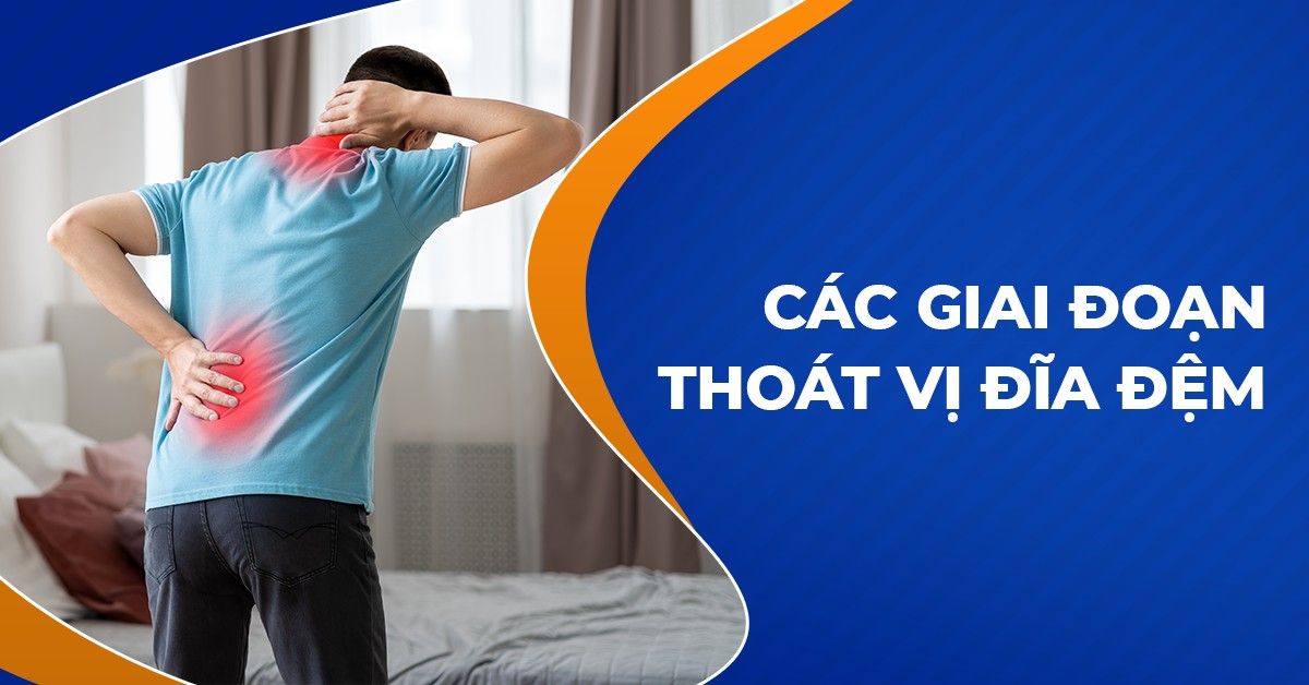 Các giai đoạn thoát vị đĩa đệm người bệnh cần lưu ý