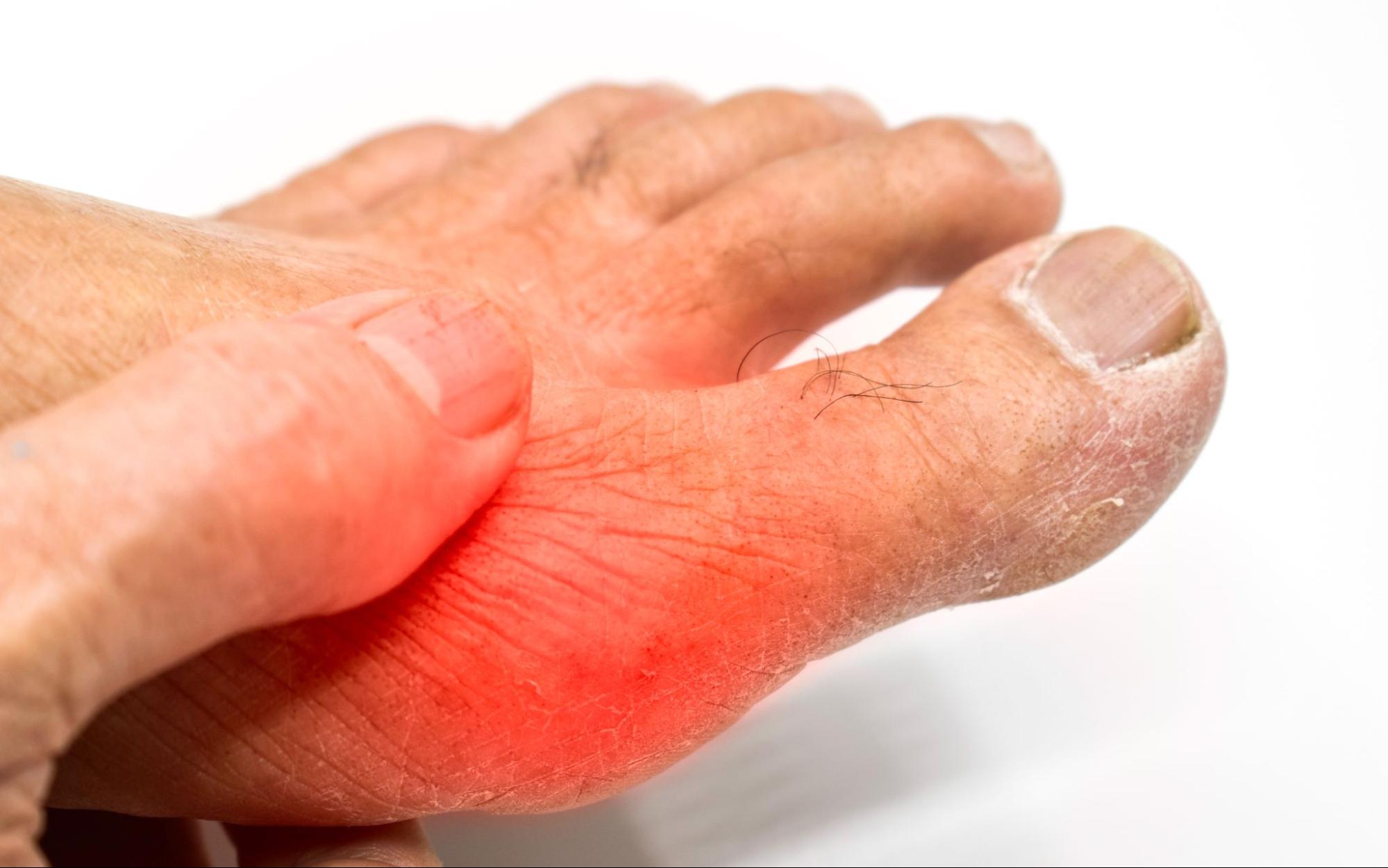 Các triệu chứng thường gặp