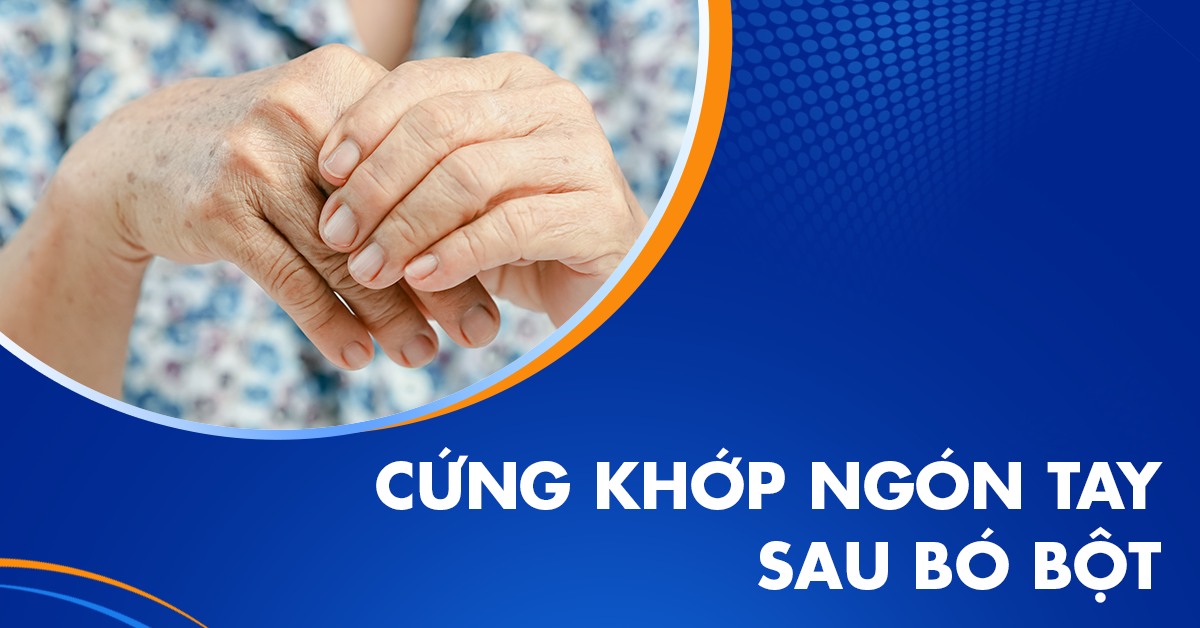 Cứng khớp ngón tay sau bó bột​ do nguyên nhân nào?