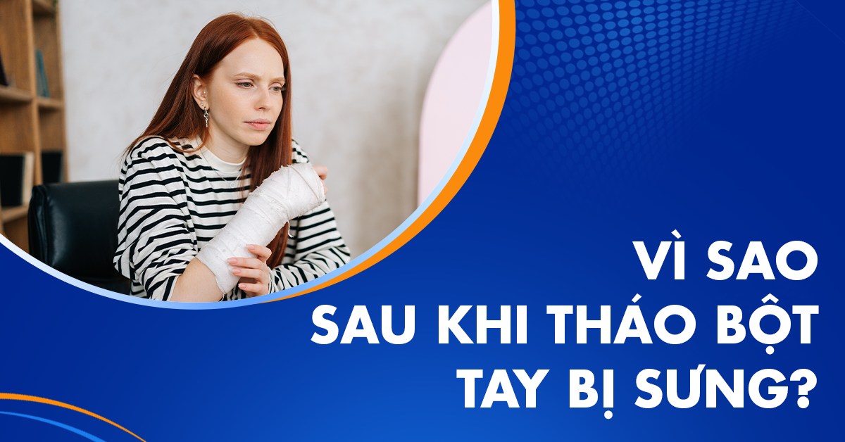 Sau khi tháo bột tay bị sưng là do đâu?