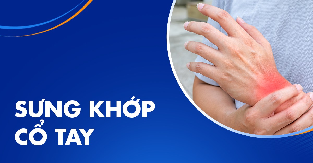 Sưng khớp cổ tay từ đâu phát sinh? Có thể xử lý không?