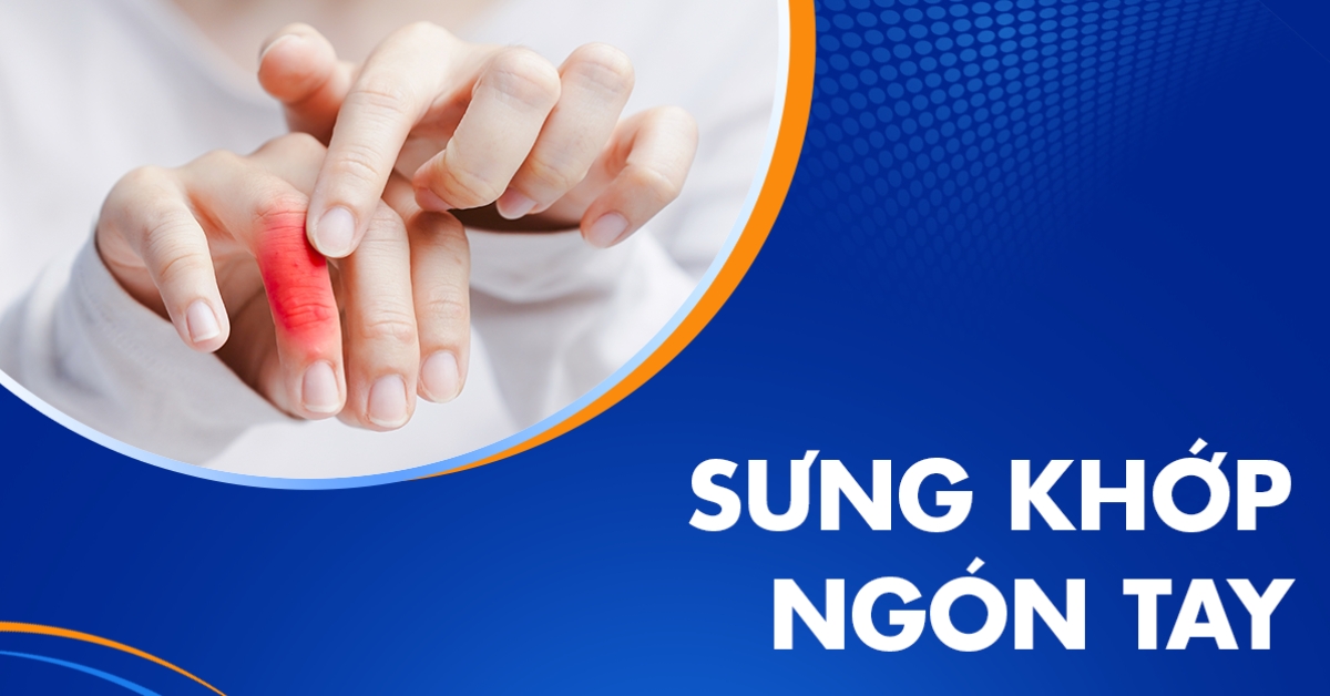 Sưng khớp ngón tay cần chọn giải pháp nào phù hợp?