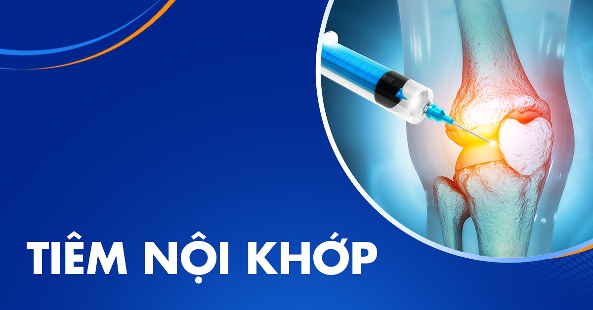 Tiêm nội khớp là gì? Khi nào nên tiêm và cần lưu ý gì?