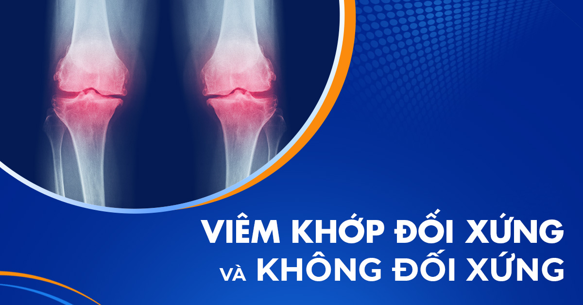 Phân biệt viêm khớp đối xứng và không đối xứng