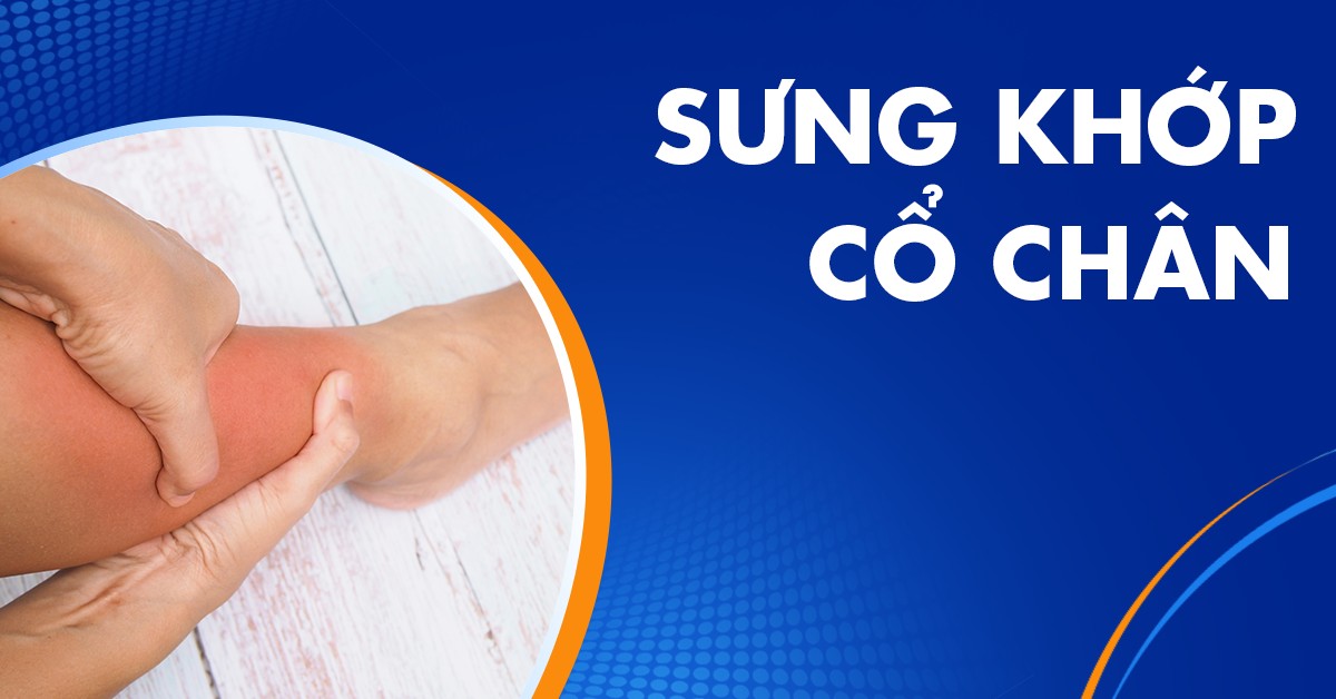Sưng khớp cổ chân có khó để khắc phục không?