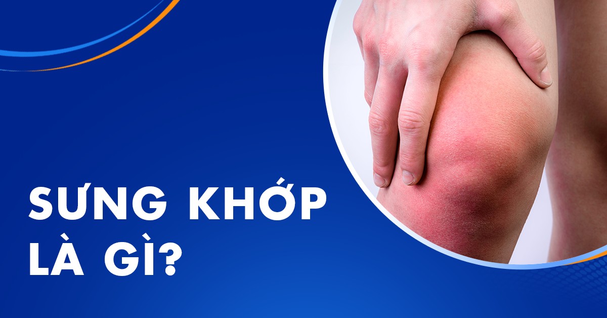 Sưng khớp là gì? Nguyên nhân và hướng điều trị an toàn