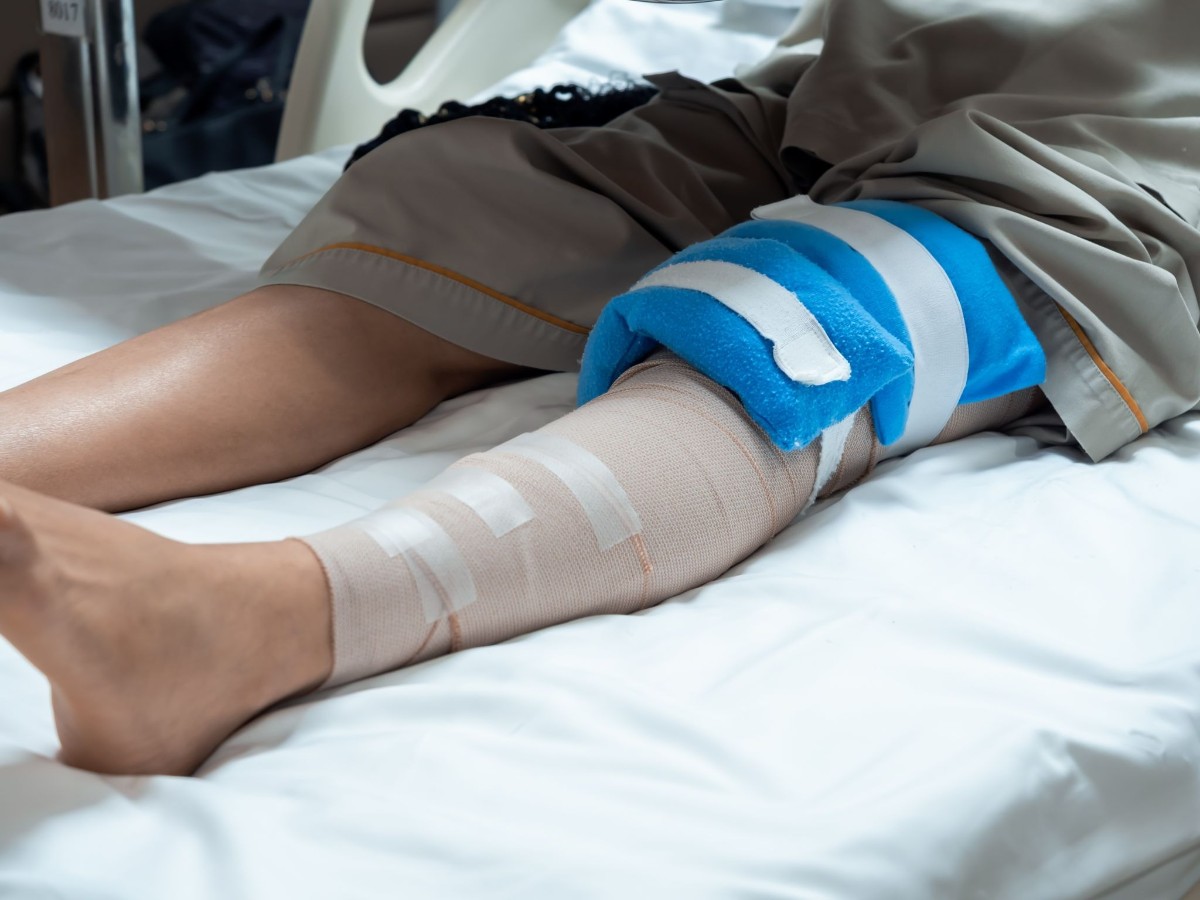 yếu tố quyết định phục hồi cứng khớp gối